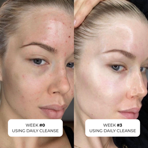 Daily Cleanse (Detox + Clear skin)