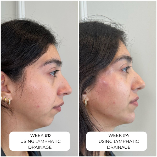 Lymphatic drainage (Debloat + Facial puffines)